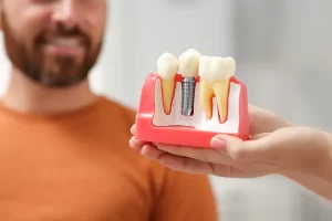 Dentist holding dental implant model in Lancaster, CA