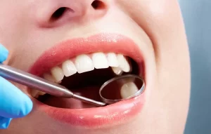 Dental Fillings in Lancaster, CA