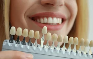 Teeth Whitening in Lancaster, CA