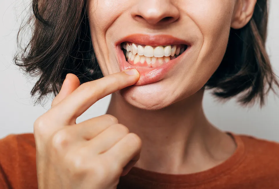 Patient showing her gum